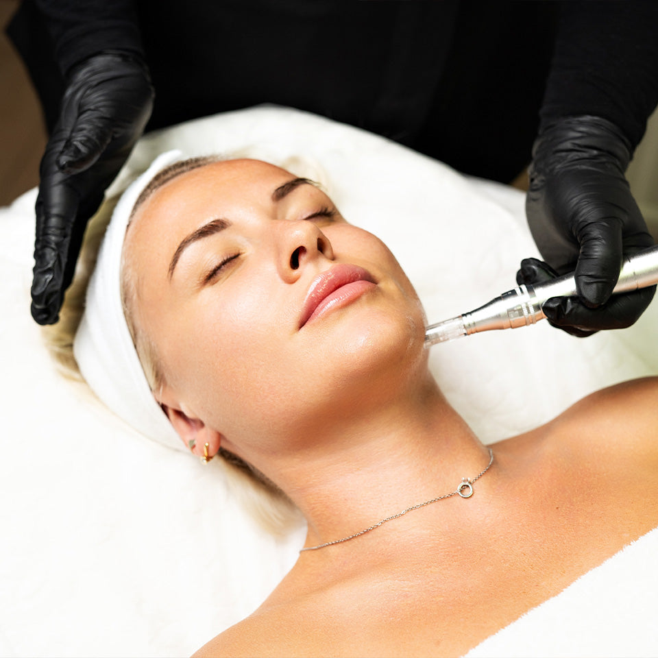 ProCell Microchanneling: My Journey to Holistic Skin Rejuvenation